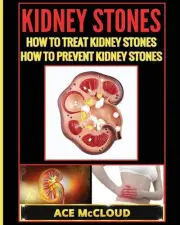 Kidney Stones: How To Treat Kidney Stones: How To Prevent Kidney Stones by Ace M
