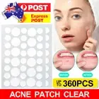 36/72/108PCS Facial Care Remover Skin Tag Acne Pimple Patch Plaster Spot Removal