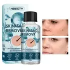 Treatment Safe Wart Acne Removal Body Face Liquid Gentle Skin Tag Remover 30ml