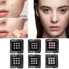 Water-soluble Salicylic Acid Painless Microneedling Patch Acne W4W8