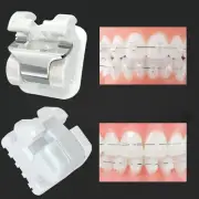 Orthodontic Self-ligating Ceramic Bracket Roth MBT 022 Ormco Damon Clear Empower