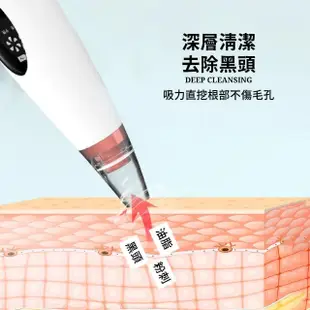 【消滅黑頭】電動黑頭粉刺毛孔清潔機-附6種吸頭(USB 去粉刺機 去黑頭儀 毛孔清潔 美容儀 潔面儀 臉部清潔)