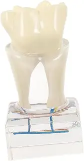 iplusmile Teaching Model Magnification Teeth Study Model for Education Demonstration and Patient Communication