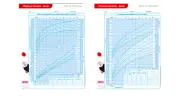 SECA-Growth charts (Boys 2-20 years), Pack of 100 Sheets