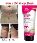 Intimify Stretch Mark Remover Cream, Stretch Mark Cream, Shaping & Firming Cream