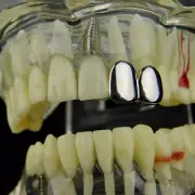 Double Cap Grillz Silver Tone Top Two Left K9 Teeth Grill Hip Hop Tooth Grills