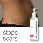 STRETCH MARK LOTION By DR COMPLEXION DUEL CONTROL 250 ml