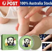 30g Anti Itch Cream for Baby Bug Repellent & Insect Repellent Cream for Mosquito