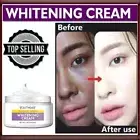 Dark Skin Whitening Dark spot Brightening Bleaching Lightening Face Cream 50ml