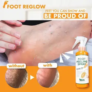 100ml Foot Peeling Spray Natural Orange Essence Pedicure Han