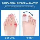 Pack of 10 Toe Spacers for Overlapping Toes, Gel Toe Separators for Men and Wome