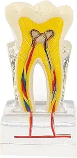 Hohopeti Teeth Model Educational Study Aid for Oral Education and Demonstration Teaching Model for Orthodontists and Practice