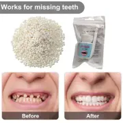 20g Dental Resin Teeth Glue Temporary Filling Teeth Repair Broken Teeth Gaps