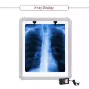 LED X-Ray Film Viewer Box SMALL(14''X17'') LARGE