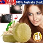 Organic Ginger Shampoo Bar Anti Hair Loss Shmpoo Soap Hair Growth Care Soap AUS~