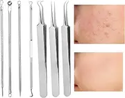 Whitehead Extraction Tool,Stainless Steel 7X Pore Cleaner Tools | Stainless Steel Blemish Cleaner Clip Face Beauty Tool For Adults Travel Use