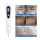 Electronic Laser Freckle Mole Warts Dot Tattoo Eraser Pen For Age Spots Removal