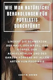 WIE MAN NATÜRLICHE BEHANDLUNGEN FÜR PSORIASIS DURCHFÜHRT : LINDERT DIE SCHMERZEN DER HAUT, DER NÄGEL, DES KOPFES, DER ACHSELHÖHLEN UND DES GANZEN KÖRPERS BEI ALLEN ARTEN VON PSORIASIS