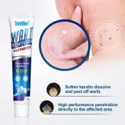 Common Wart Remover Skin Tags Remover Ointment Natural Wart Removal Skin
