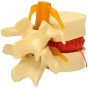 Lumbar Vertebrae Model Anatomical Spine Lumbar Disc Herniation Anatomy1388