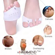 Pedimend Bunion Pain Relief Toe Separator Prevent Hallux Valgus & Hammer Toe 2PC