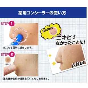 【ACNE BARRIER】男性遮瑕膏(專為男性膚色設計 男用遮瑕兩色可選 疤痕說掰掰)