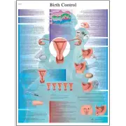 3B Scientific VR1591L Glossy Laminated Paper Birth Control Anatomical Chart, ...