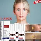 1-3B Whiting And Freckle Removing Serum Cream Dark Spot Removing Freckle Essence