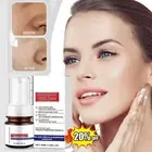 Anti Spot Serum, Freckle Removing Essence, Vitamin C Freckle Cream 40ml