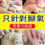 無效全額退費⭐腳氣噴劑殺菌止癢去腳氣香港腳噴劑治爛腳丫糜爛腳腳氣水去腳汗腳底發白瘙癢足爽腳臭粉去水泡水疹脫皮腳氣正品