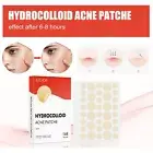 Pimple Patches Hydrocolloid Master Acne Spot Treatment Skin Tag Remover Patch