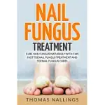 NAIL FUNGUS TREATMENT: CURE NAIL FUNGUS NATURALLY WITH THIS FAST TOENAIL FUNGUS TREATMENT AND TOENAIL FUNGUS CURES