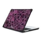MacBook Air 13-inch (M2 - M4) Bounce Case RM Pink Flowers