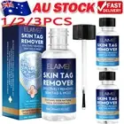Fast Skin Tag Remover Instant Treatment Safe Wart Acne Removal Body Face Liquid