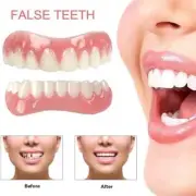 Silicone Denture Veneers in Stock Teeth False Denture Bad Teeth Veneers Teeth