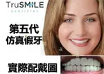 TRU SMILE 第五代仿真牙套 製假牙 假牙套 牙洞修 補牙洞 可脫卸 美容牙套 美齒牙套 假牙貼片 口腔 遮醜