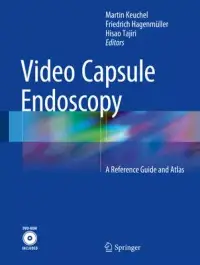 在飛比找博客來優惠-Video Capsule Endoscopy: A Ref