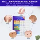 Acne Wart Removal Safe Gentle Skin Tag Remover Patch Face Body Treatment