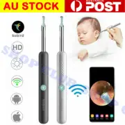 Bebird Ear Wax Removal Ear Cleaning Endoscope Spoon Mini Camera Ear Picker 1080P