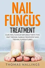 Nail Fungus Treatment: Cure Nail Fungus Naturally With This Fast Toenail Fungus Treatment and Toenail Fungus Cures