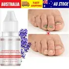 Nail Fungus Treatment Repair Essence to Remove Foot Toe Fungal Anti-Infection