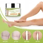 TREATMENT CREAM VARICOSE VEINS VASCULITIS PHLEBITIS SPIDER VEINS STRETCH MARKS