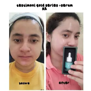 serum DAVENA redy Setok