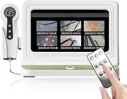 10 Inch LCD Scalp Detector, Digital Hair Skin Analyzer Microscope, Remote Control + 50/200× Binoculars + Frame Comparison, for Hair Follicle Testing and Skin Analysis,White