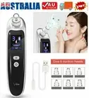Remover Face Facial Pore Blackhead Vacuum Derma Suction Diamond Dermabrasion AU