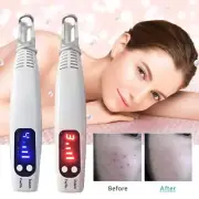 Portable Home Picosecond Tattoo Removal Pen For Mole Scar] Acne Spot UK PLUG！