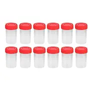 25pcs Practical Plastic Specimen Cup Urine Container 60ml Eo Sterile Without Lable Laboratory Medical Use (random Color)