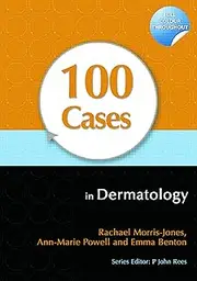100 Cases in Dermatology