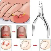 Cuticle Scissors Pedicure Toenail Cutter Paronychia Clippers Manicure New