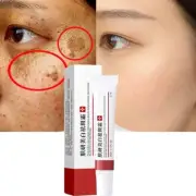 Whitening Cream Dilute Spots Remove Acne Improve Dark Skin Freckle Cream